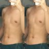 centslim